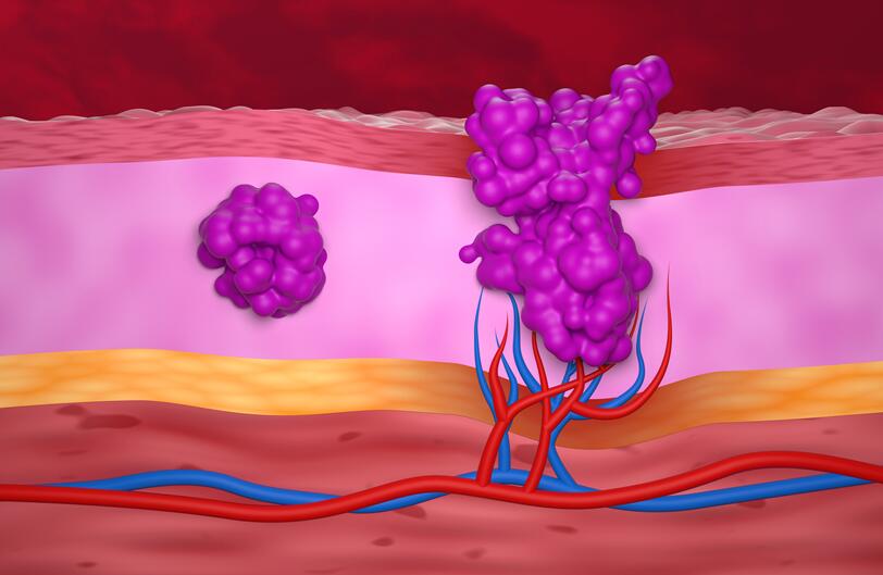 Collection of skin tumor cell lines including melanoma and squamous cell carcinoma models