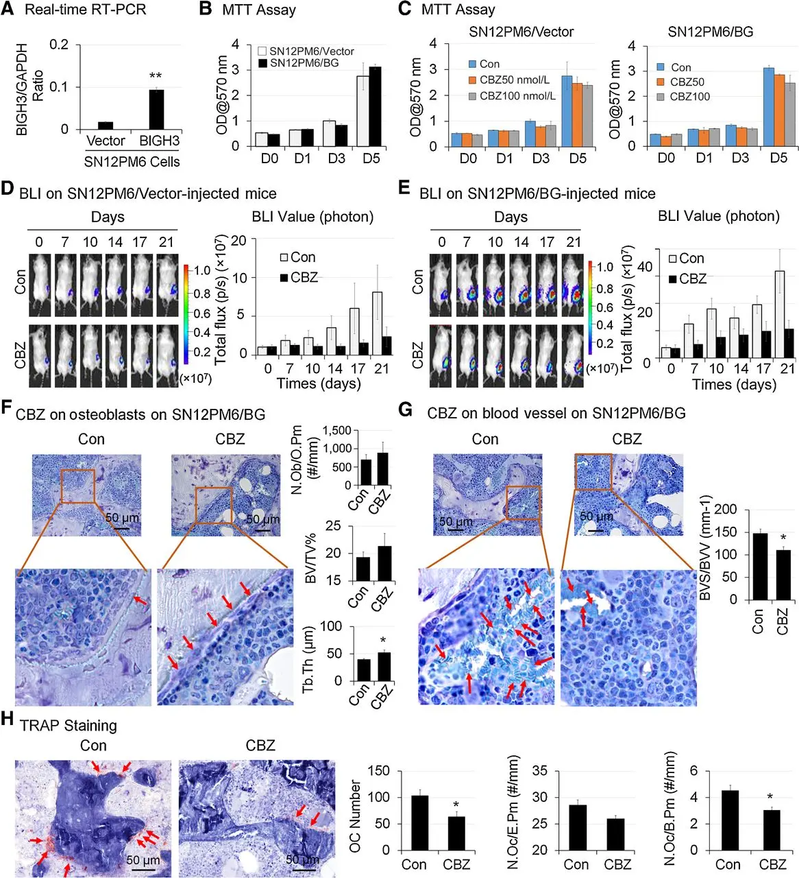 Effects of CBZ on the growth of SN12PM6 renal cell carcinoma in bone in vivo.