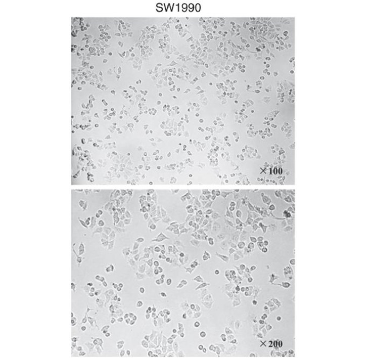 SW1990 cell morphologies were observed under an optical microscope (x100; x200 magnification).