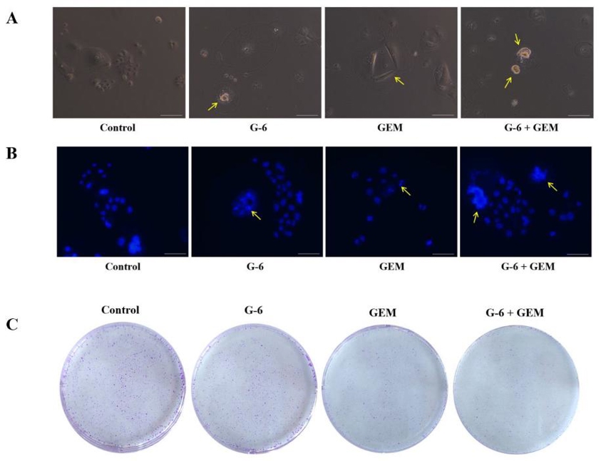 Inhibitory effect of G-6 combined with GEM in SW1990 cells.
