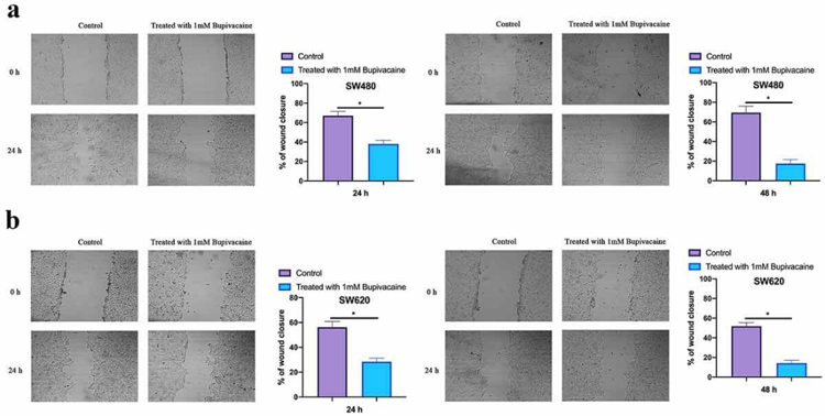 Bupivacaine Inhibited CRC Cell Migration