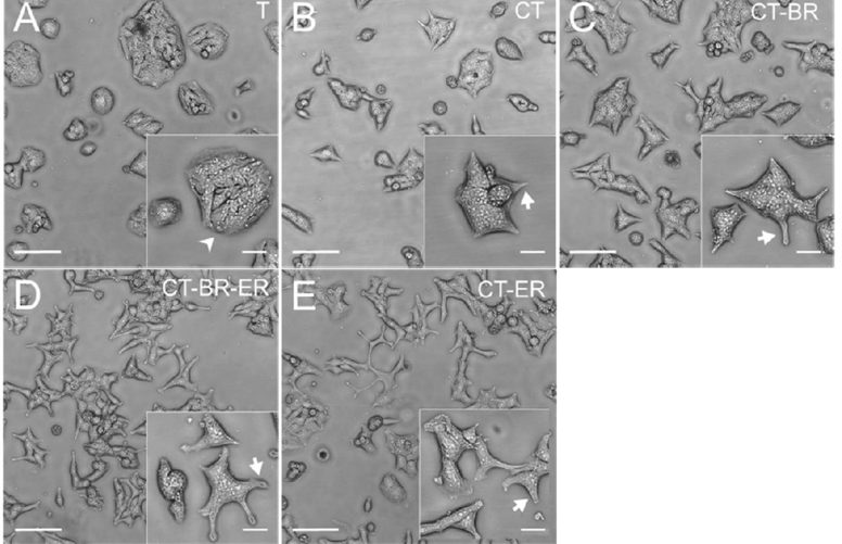 Growth characteristics and morphology of VCaP cell lines with different sensitivity to testosterone (A-B) and drug resistances (C-E).