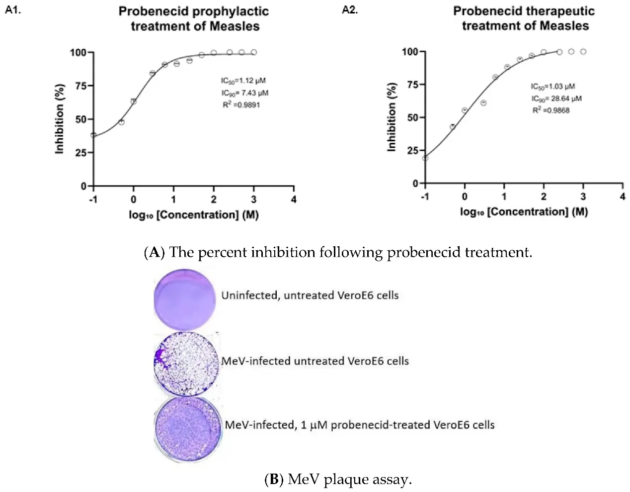(A) VeroE6 cells were (A1) prophylactically treated with probenecid 24 h before infection with Edmonston MeV (MOI = 0.1), or (A2) treated 1 h after infection with probenecid at the specified concentrations. (B) is a representative well from a 6-well MeV plaque assay of VeroE6 cells from uninfected, MeV-infected, or MeV-infected 1 µM probenecid-treated VeroE6 cells.