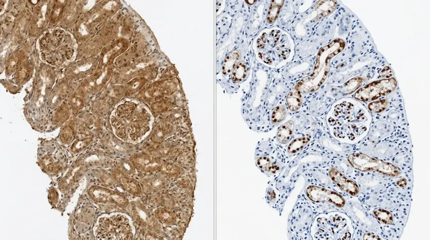 High IHC background versus optimized target staining. Excessive diffuse DAB staining can obscure tissue morphology and reduce the signal-to-noise ratio, whereas an optimized protocol produces localized, interpretable target staining with minimal non-specific background.