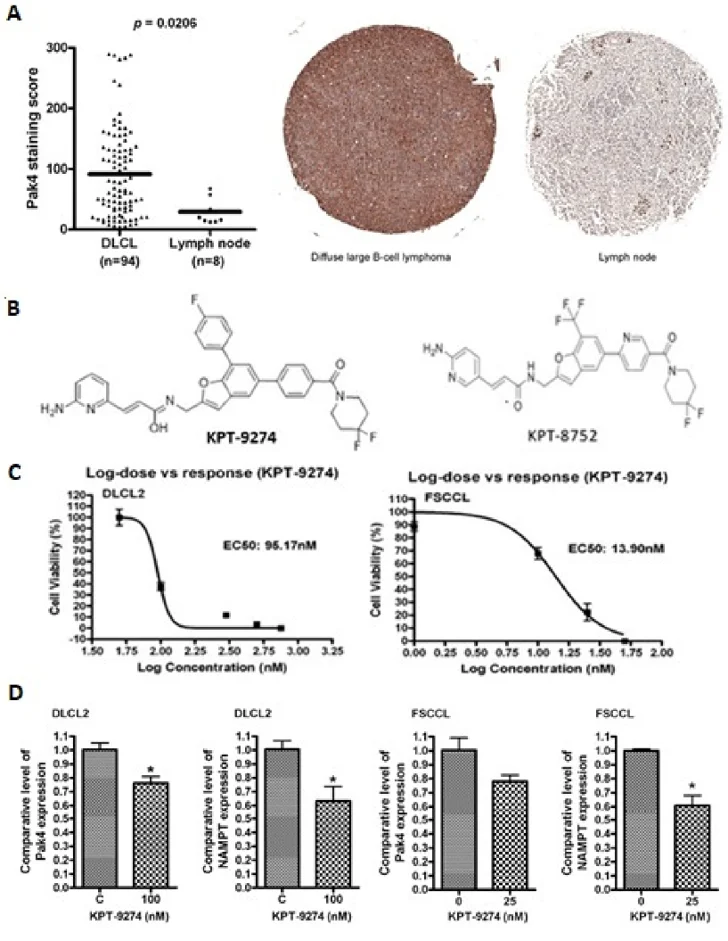 PAK4-NAMPT is critical for WSU-DLBCL and WSU-FSCCL cell sustenance.