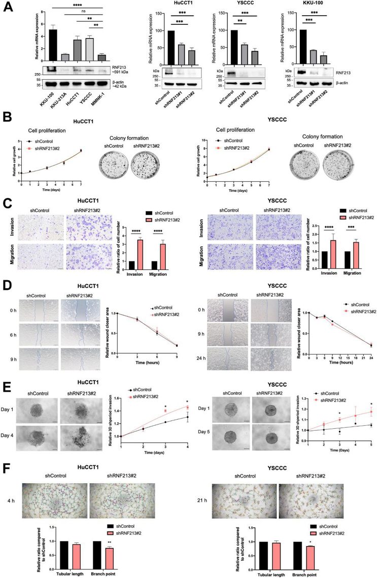 The effect of RNF213 knockdown on proliferation, migration, and invasion of CCA cell lines.