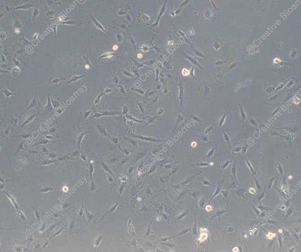 Immortalized Human Podocytes