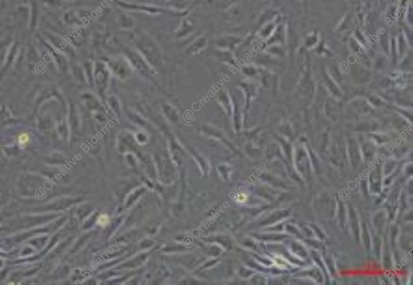 Immortalized Human Lymphatic Endothelial Cells-SV40