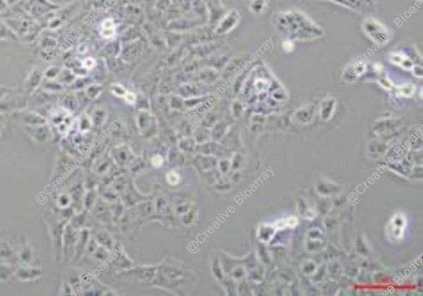 Immortalized Human Thyroid Epithelial Cells-SV40T