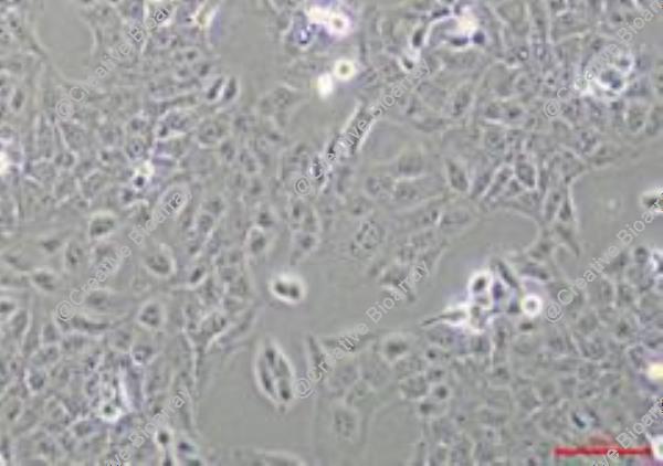 Immortalized Human Thyroid Epithelial Cells-SV40T