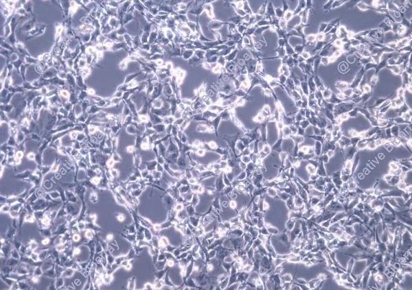 12Z Immortalized Human Endometrial Epithelial Cell Line
