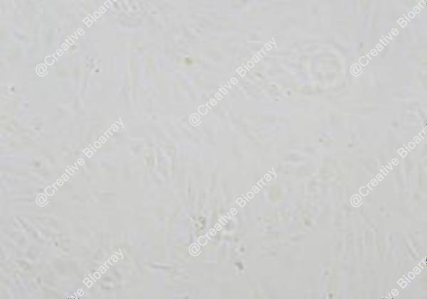 Immortalized Human Umbilical Vein Endothelial Cells-SV40