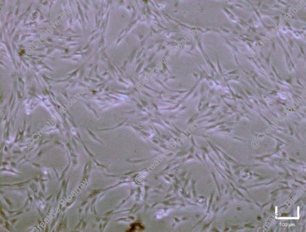 Immortalized Human Skeletal Muscle Myoblasts