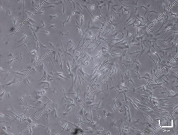 Immortalized Human Primary Trabecular Meshwork Cells-SV40