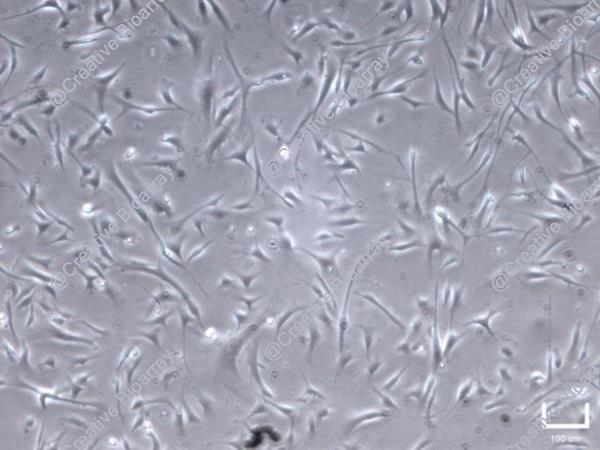 Immortalized Human Primary Trabecular Meshwork Cells-SV40