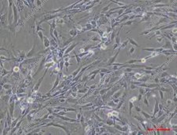 Immortalized Human Sertoli Cells-SV40