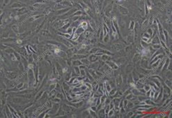 Immortalized Human Hepatic Sinusoidal Endothelial Cells