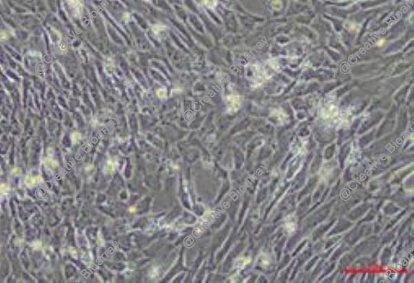 Immortalized Mouse Hepatic Stellate Cells-SV40T
